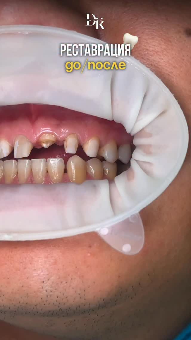 Художественная реставрация